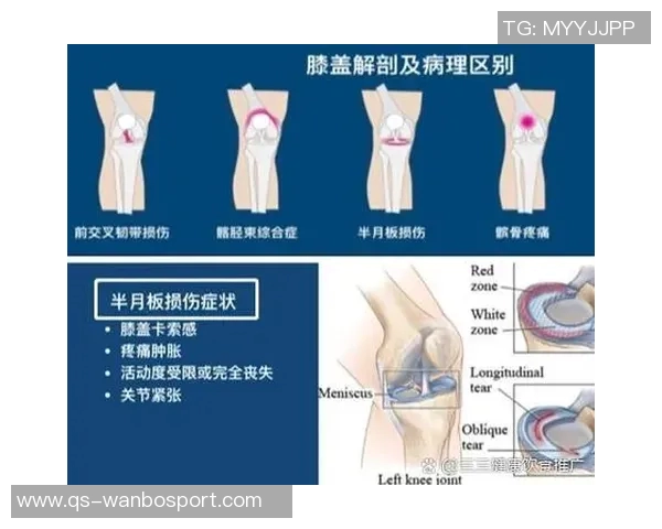 加比亚左膝过度伸展受伤情况更新已排除韧带和半月板损伤风险